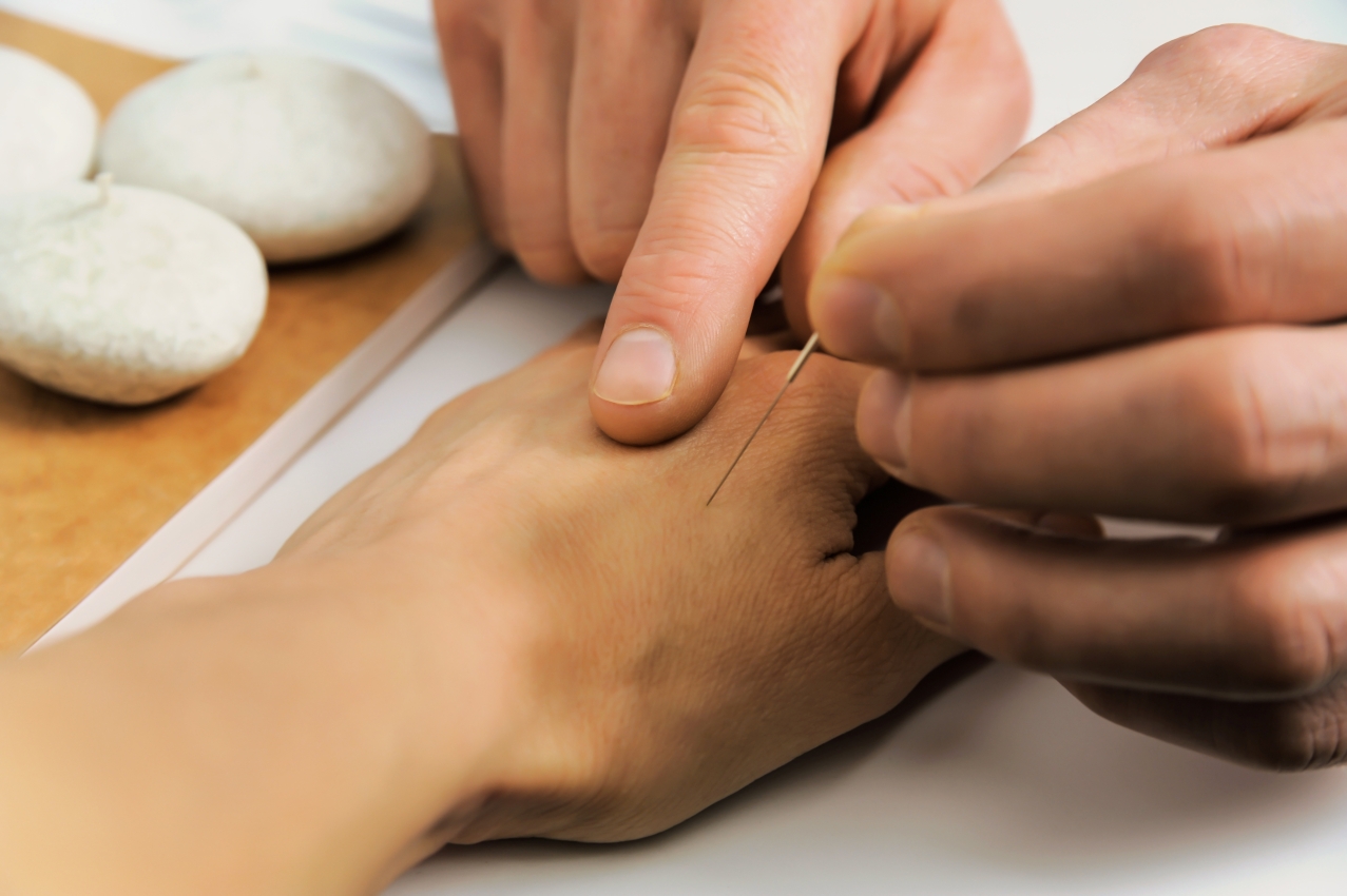 needle therapy small